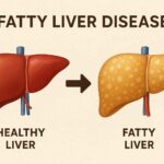 What are the Symptoms of fatty liver disease