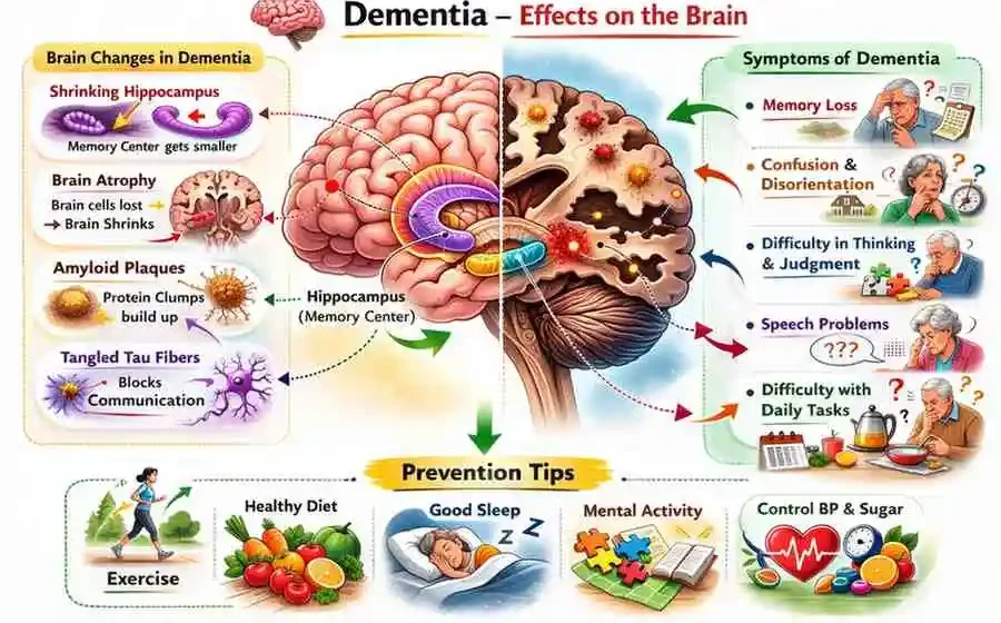 Early Signs of Alzheimer’s You Should Never Ignore in 2026 Early Signs of Alzheimer’s You Should Never Ignore in 2026