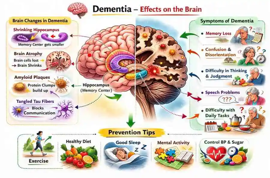 Early Signs of Alzheimer’s You Should Never Ignore in 2026